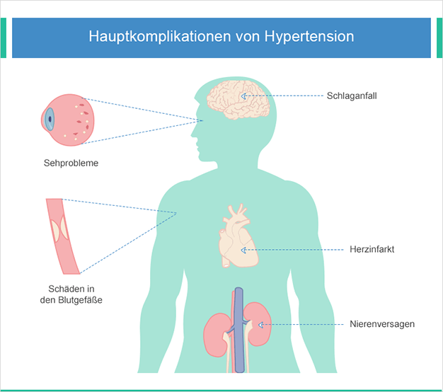 Bluthochdruck Behandlung Rezeptfrei Online