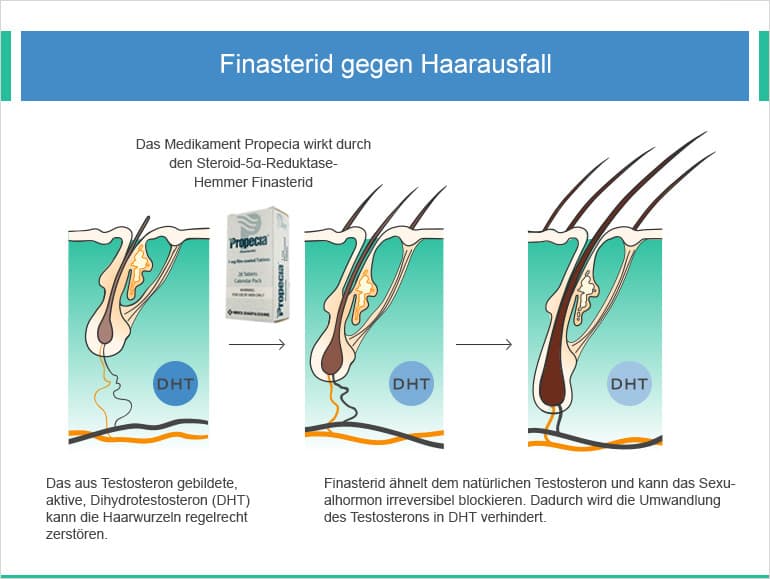 Tabletten Haarausfall Propecia